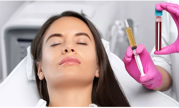 PRF: Platelet Rich Fibrin