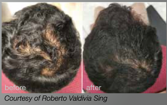 HAIRestart™ Growth Program