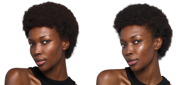 JUVÉDERM® SKINVIVE™